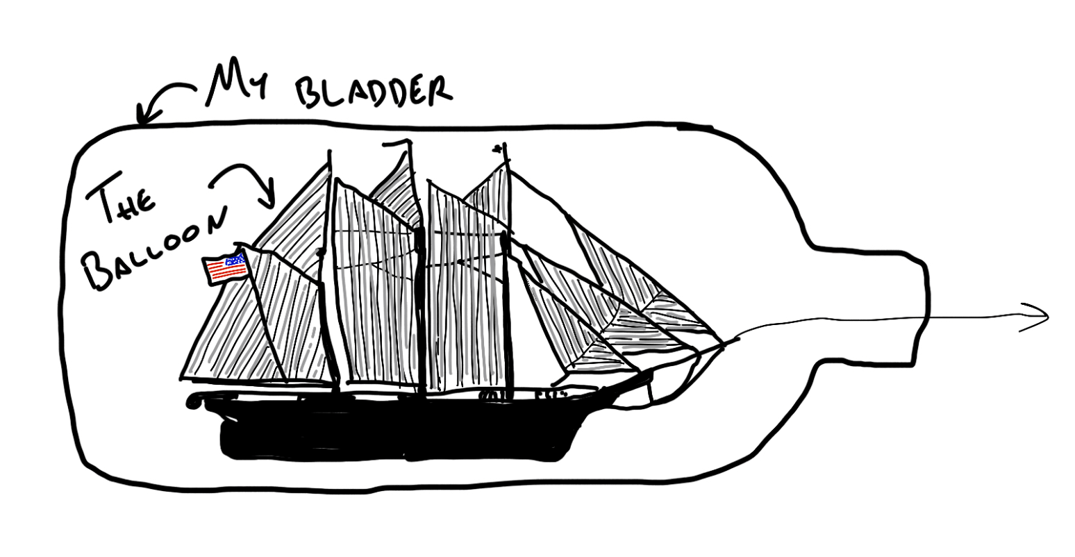 Drawing of a ship in a bottle, where the bottle is my bladder and the ship is the balloon